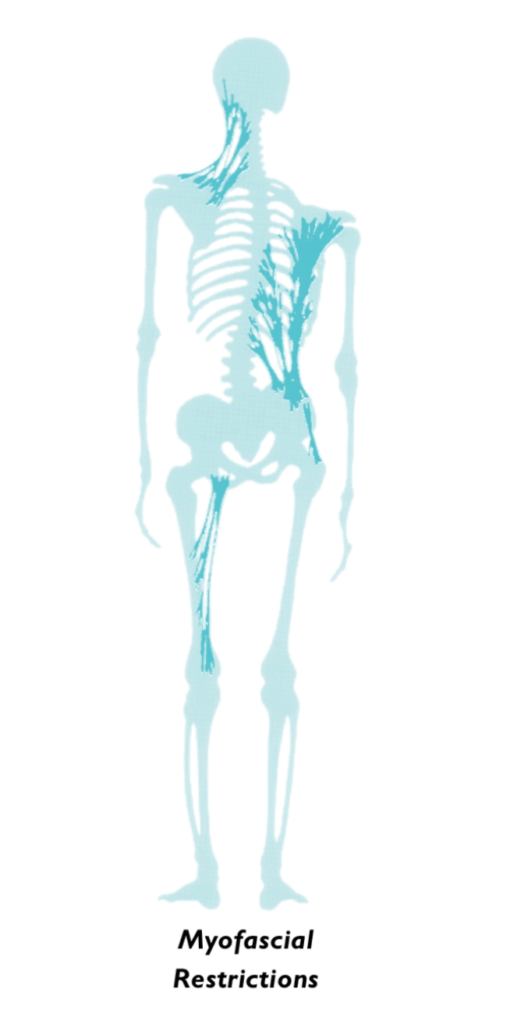 全身がつながる「筋膜(ファシア)」
