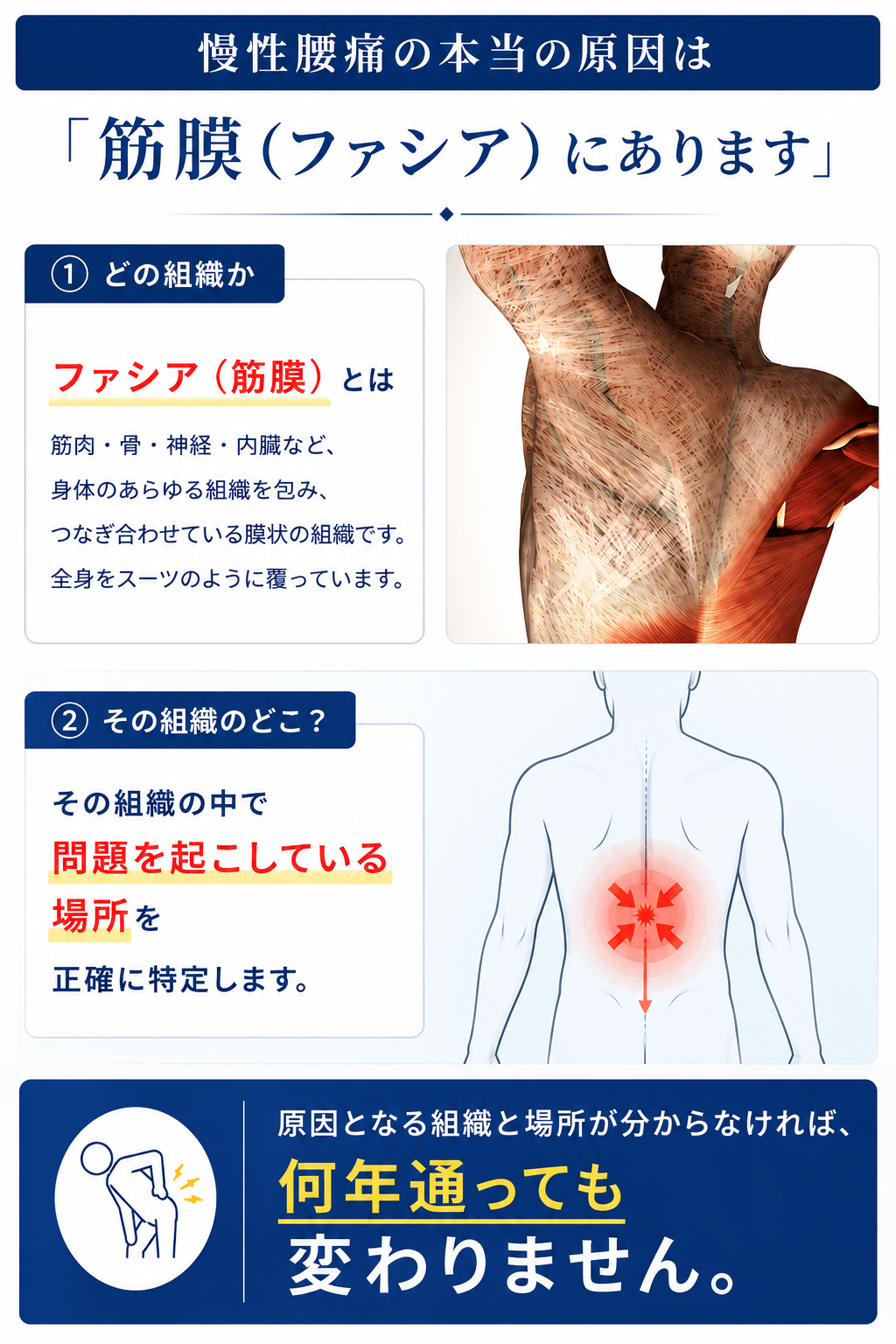 慢性腰痛の本当の原因は筋膜（ファシア）にあります