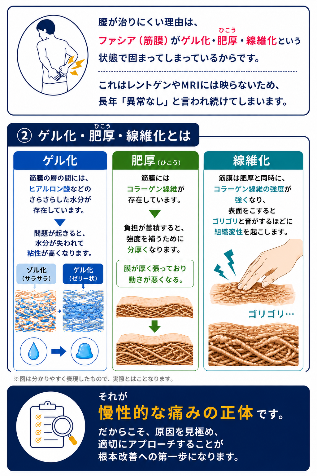 腰が治りにくい理由
