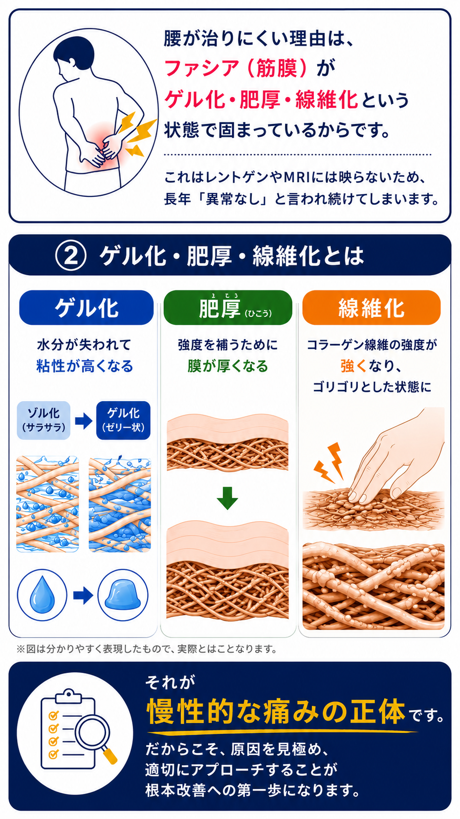 腰が治りにくい理由